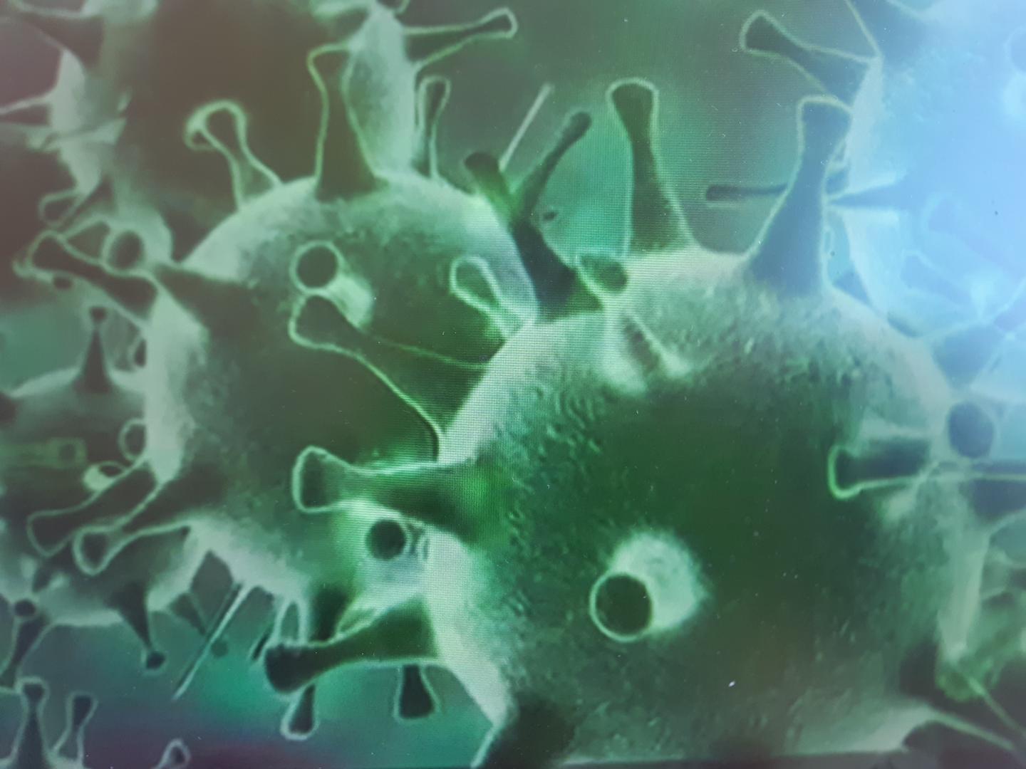 Update COVID-19 21 September 2020